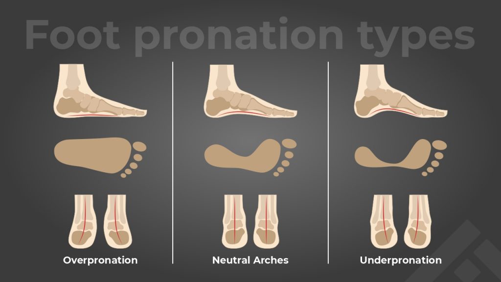 Foot type: Types of pronation