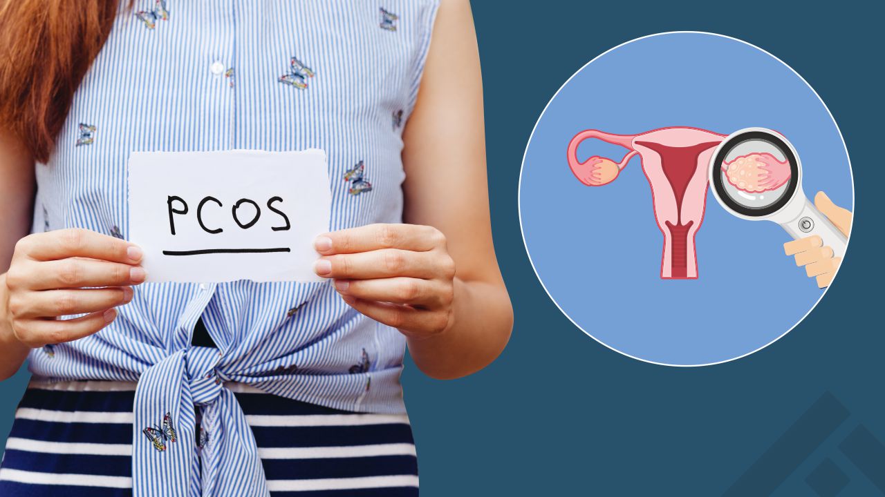 PCOS: A Conversation You Should Be Having Right Now