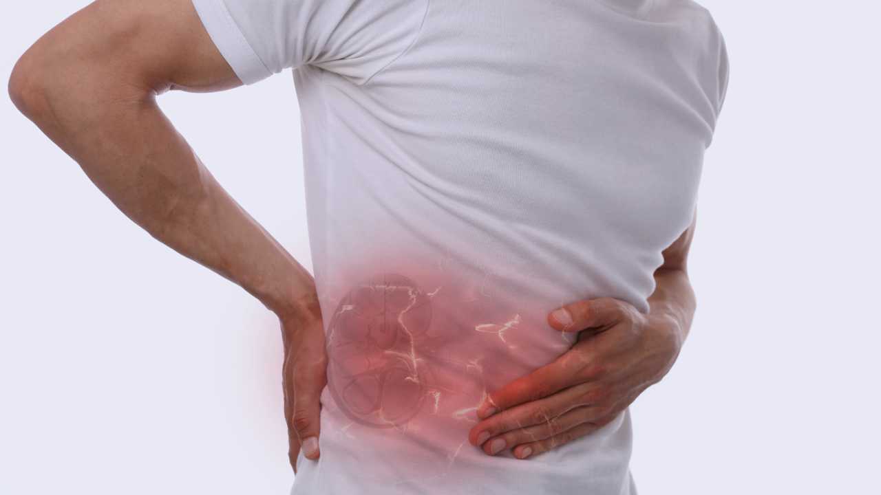 Kidney Stones: Symptoms, Diagnosis and Treatment