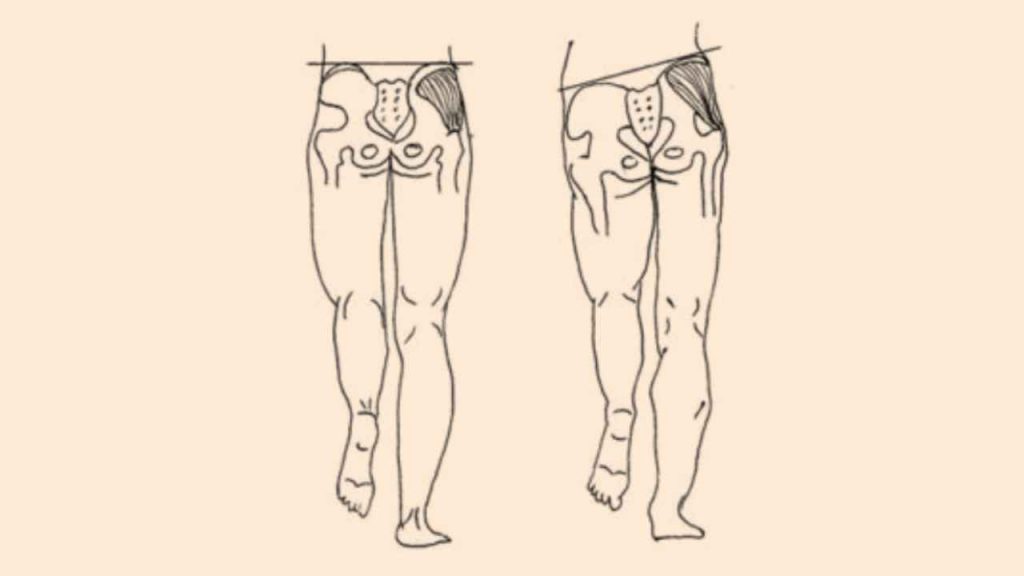 Illustration of hip drop