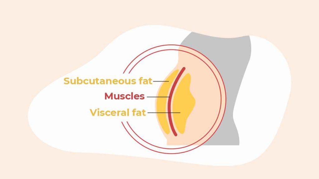Forms of abdominal fat: Subcutaneous fat and visceral fat