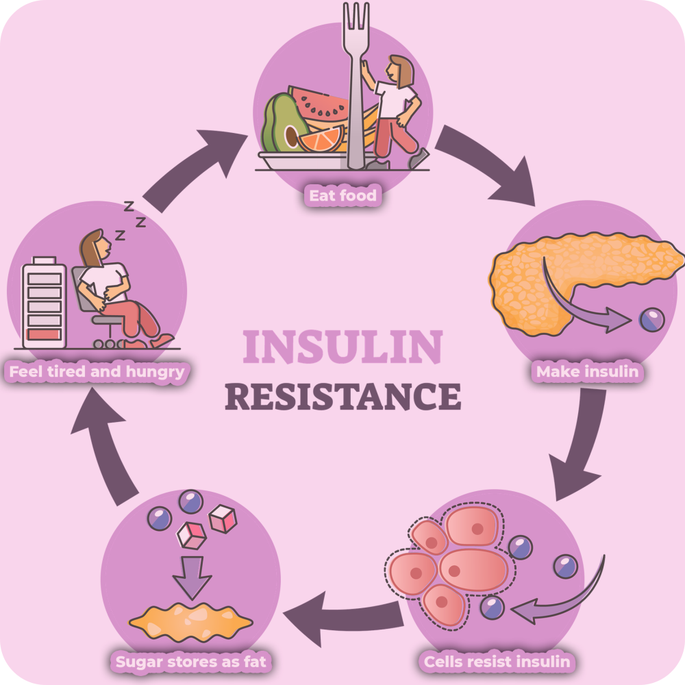 Insulin resistance - A visual representation