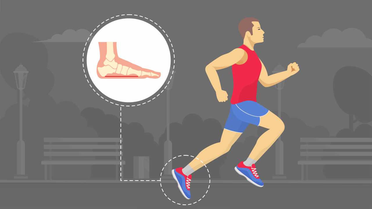 How Can Runners with Flat Feet Avoid Injuries?