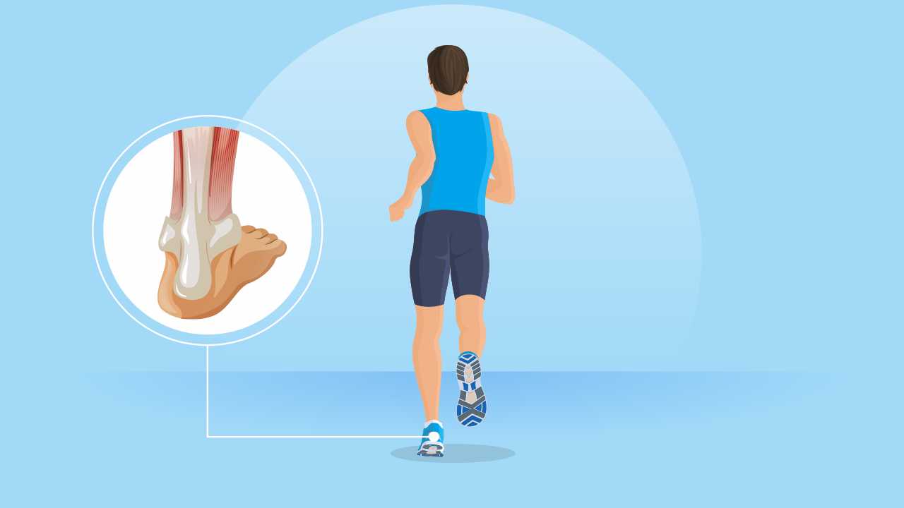 Exercises to strengthen the Achilles tendon and triceps surae